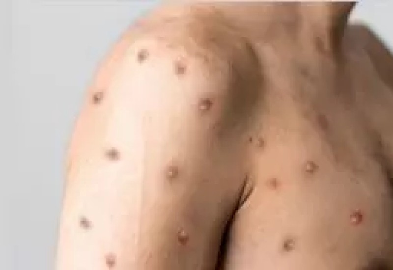 Foto: Prefeitura de Chapecó