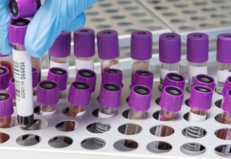 Queda dos índices relacionados a Covid-19 foram divulgados neste sábado (17)