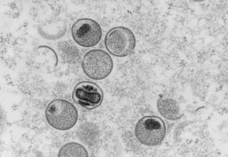 Foto: FREYA KAULBARS / RKI ROBERT KOCH INSTITUTE / AFP